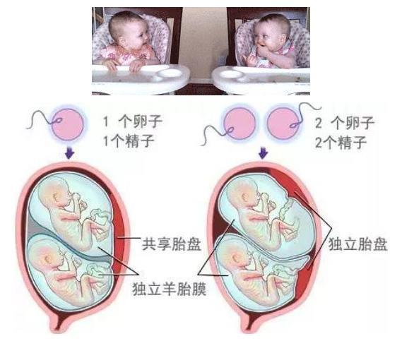 包生男孩包双胞胎-包生男孩包双胞胎的奇妙故事